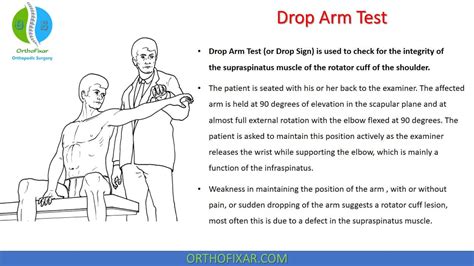 drop arm test positive|drop arm test sensitivity specificity.